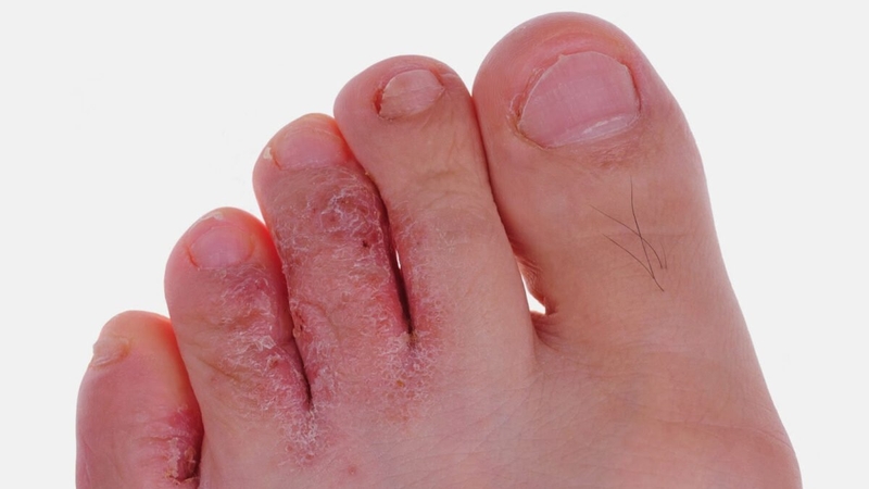 Mách bạn một vài phương pháp dưỡng da chân tại nhà 3