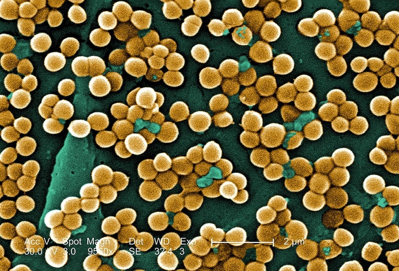 MRSA là gì? Nguyên nhân, dấu hiệu và cách điều trị khi nhiễm MRSA 1