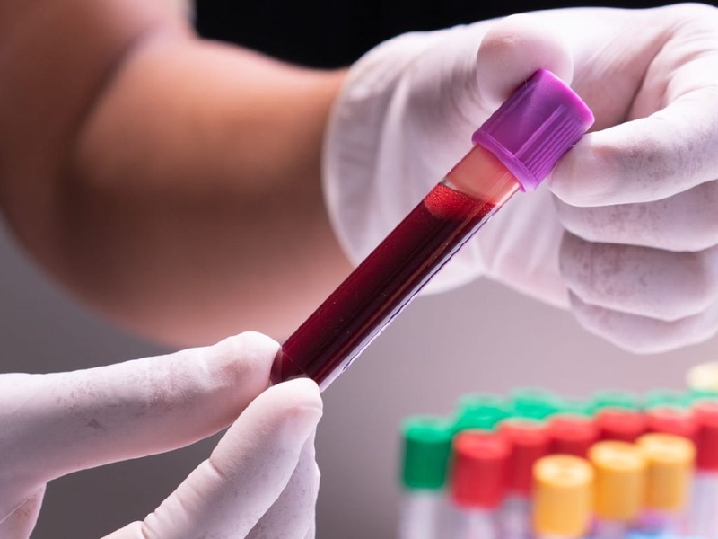 MRSA và cảnh báo những yếu tố nguy cơ nhiễm MRSA, chẩn đoán và cách phòng ngừa 3