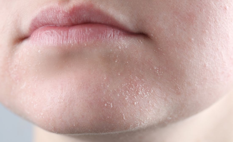 Mùa đông có nên dùng sữa rửa mặt​ không? Hé lộ từ chuyên gia da liễu 1