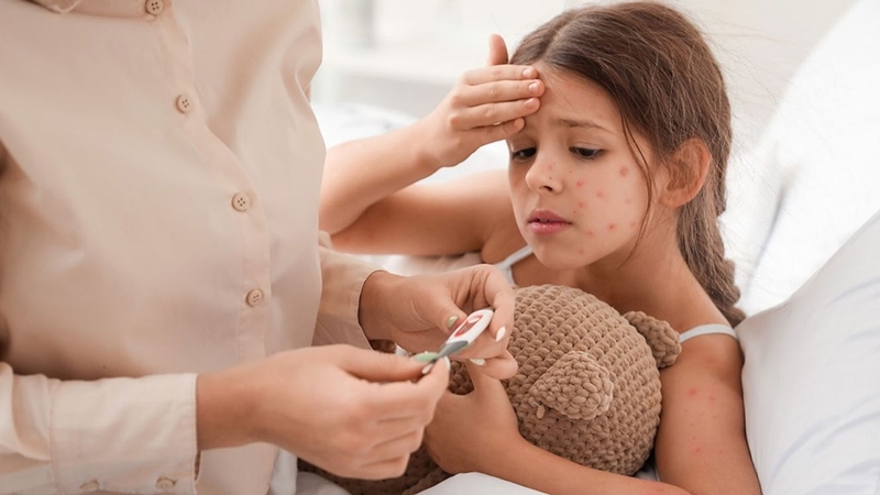 Mùa thủy đậu vào tháng mấy? Cách phòng ngừa bệnh hiệu quả 4