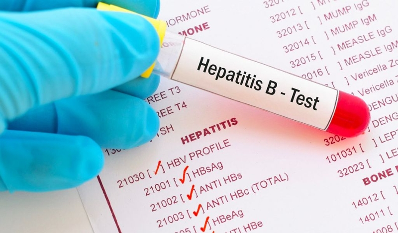 Mục đích của định lượng virus viêm gan B là gì? 2