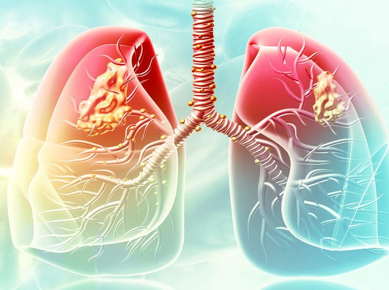 Mức độ nguy hiểm, nguyên nhân và triệu chứng hen phế quản ở trẻ em 1