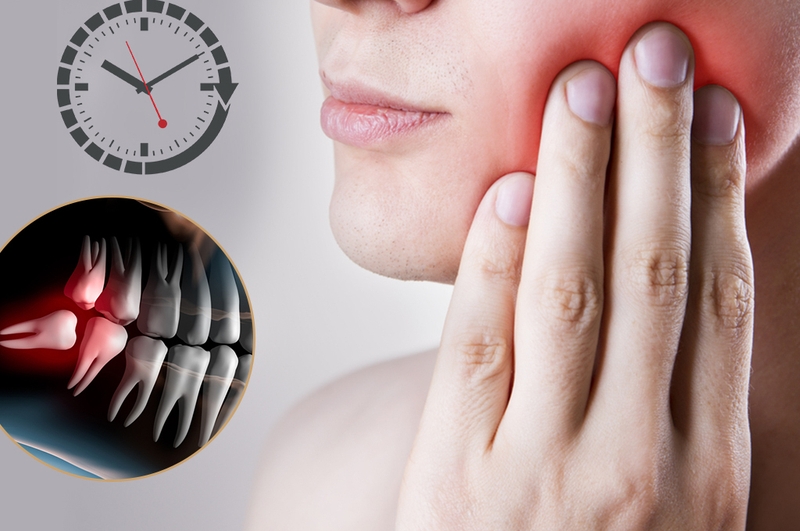 Mức độ nguy hiểm và hướng xử trí tình trạng mọc răng khôn nổi hạch 2