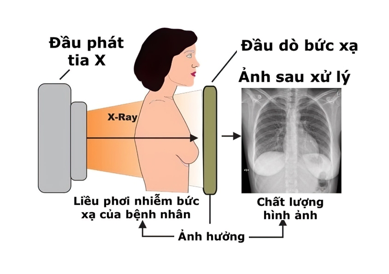 Mức độ phóng xạ khi chụp X quang có đủ để gây nguy hiểm không 2