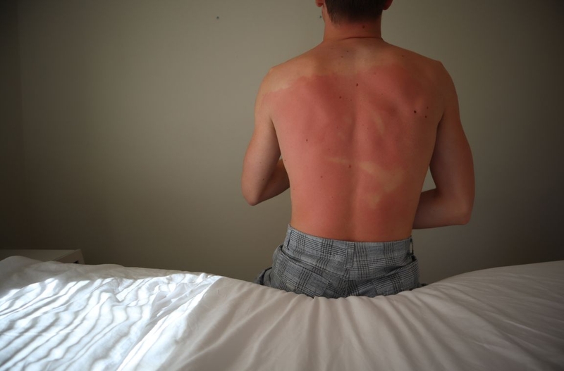 Mức độ phóng xạ khi chụp X quang có đủ để gây nguy hiểm không 3