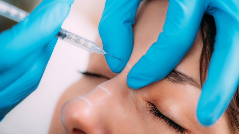 Mũi gồ là gì? Nguyên nhân và cách khắc phục mũi gồ hiệu quả 3