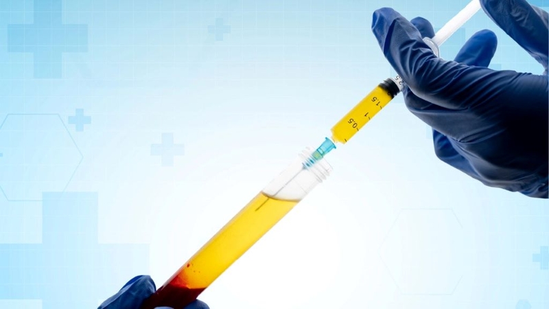 Mũi tiêm huyết tương giàu tiểu cầu giá bao nhiêu? Phương pháp điều trị bệnh thoái hóa khớp gối 2