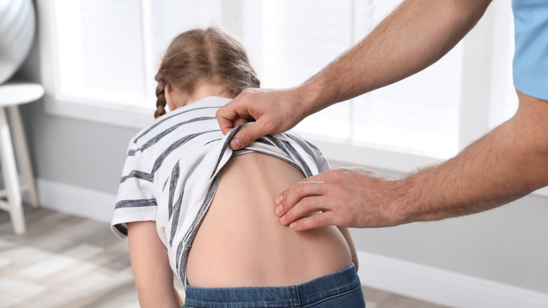 Biến dạng thành ngực đôi khi có thể đi kèm vẹo cột sống