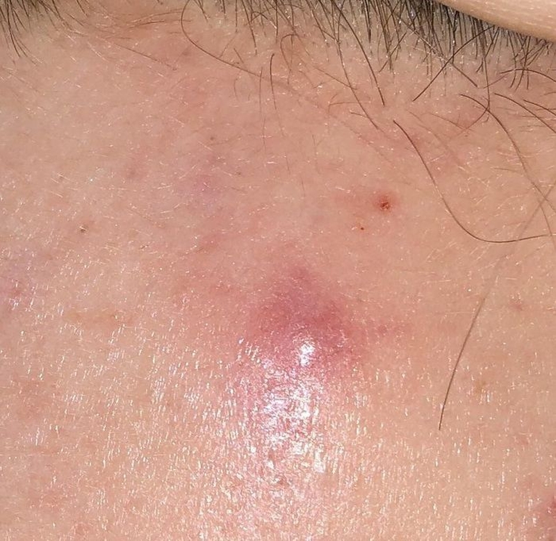 có hình dạng sưng to, đỏ và gây đau nhức 3