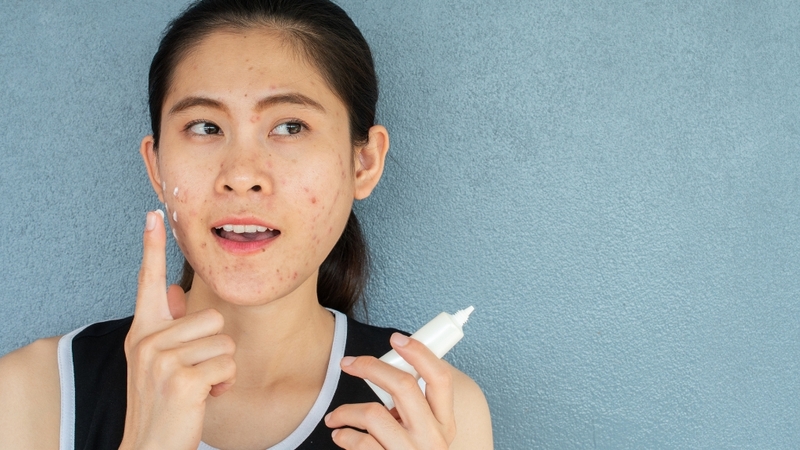 Làm sạch da và dùng hoạt chất phù hợp giúp kiểm soát mụn, hạn chế kích ứng