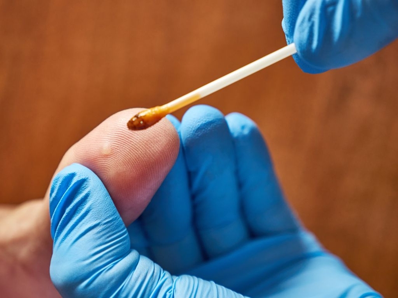 Mụn cóc có đau không? Các biện pháp phòng ngừa mụn cóc hiệu quả 3