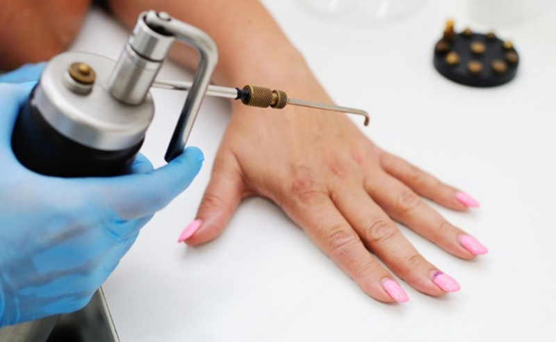 Mụn cóc có ngứa không? Có tự hết không?