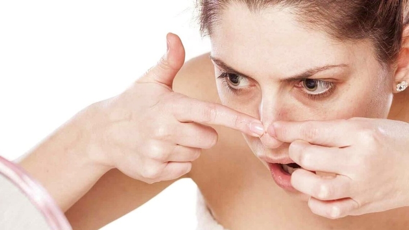 Mụn đầu đen có tự hết được không? 2