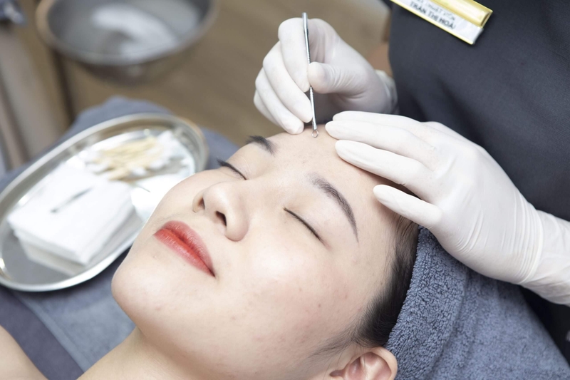 Mụn đầu đen có tự hết được không? 3