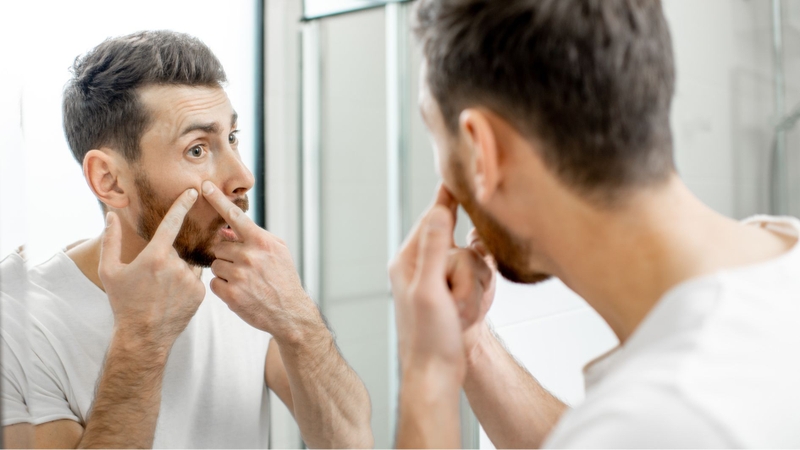 Tuyệt đối không tự ý nặn mụn đinh râu để tránh nhiễm trùng lan rộng