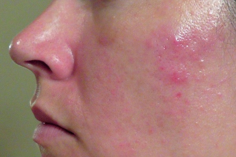 có hình dạng sưng to, đỏ và gây đau nhức 2