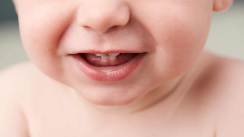 Mụn trắng ở lợi trẻ sơ sinh: Nguyên nhân và phương pháp điều trị  1