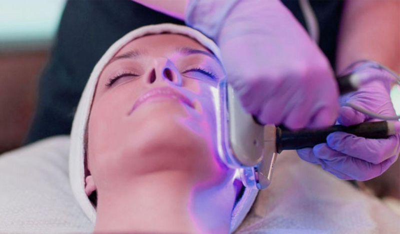 ​​​​​​​Can thiệp các biện pháp y tế là một trong những cách điều trị mụn nhanh chóng nhất