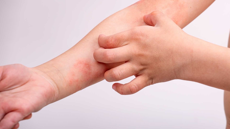 Mứt gừng bao nhiêu calo? Lưu ý khi ăn để tránh ảnh hưởng sức khỏe - 5