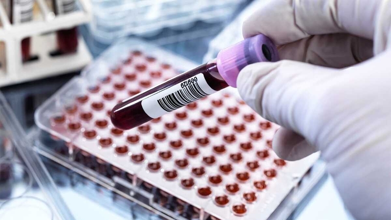 myoglobin-la-gi-xet-nghiem-myoglobin-de-chan-doan-van-de-tim-mach 2.jpg