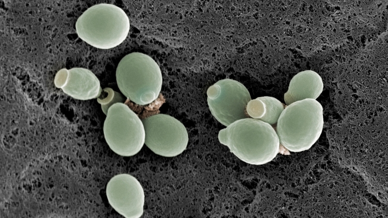 Giải đáp thắc mắc nấm Candida chết ở nhiệt độ bao nhiêu