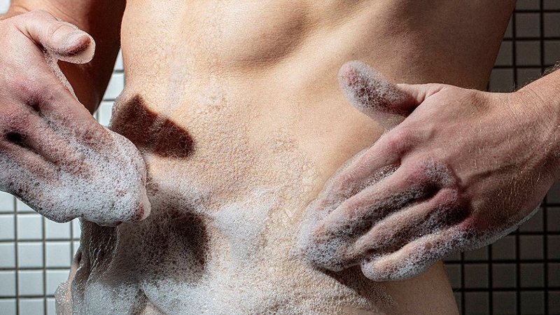 Nấm Candida ở nam giới: Mức độ nguy hiểm ra sao? 3