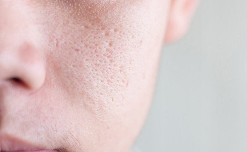 Nam có dùng được sữa rửa mặt của nữ không 1