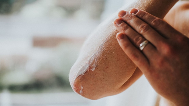 Nằm đệm sưởi liên tục có thể dẫn đến khô da và mất nước nếu không bổ sung đủ nước