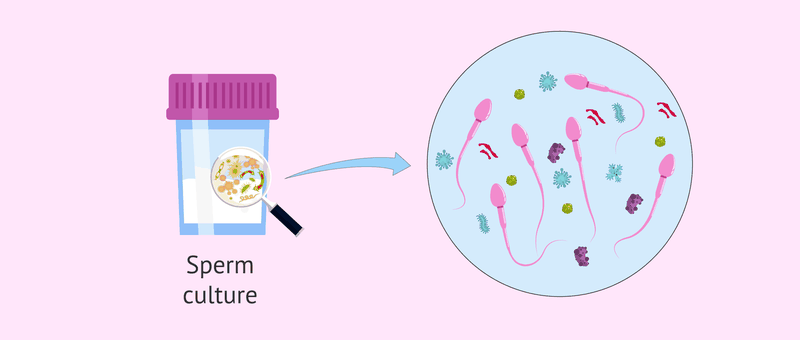 Nam giới nên xét nghiệm tinh dịch đồ để làm gì? 3