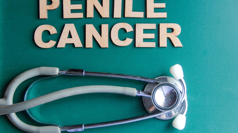 Ung thư dương vật là một trong những bệnh do nhiễm HPV ở nam giới