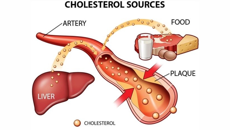 Nam giới phải làm gì để giảm cholesterol nhanh chóng