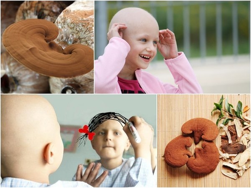 nam-linh-chi-chua-benh-gi-cong-dung-that-su-cua-nam-linh-chi