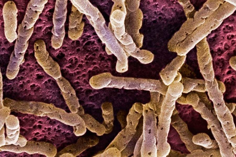 Nấm mắt là gì? - Triệu chứng và nguyên nhân gây bệnh nấm mắt 2