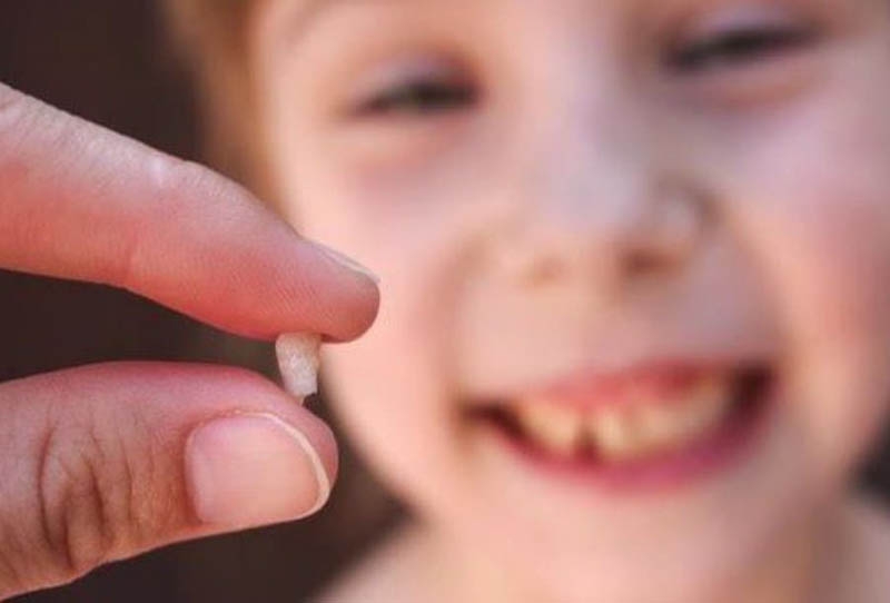 Giấc mơ thấy răng bị gãy, rụng là một trong những giấc mơ khá phổ biến