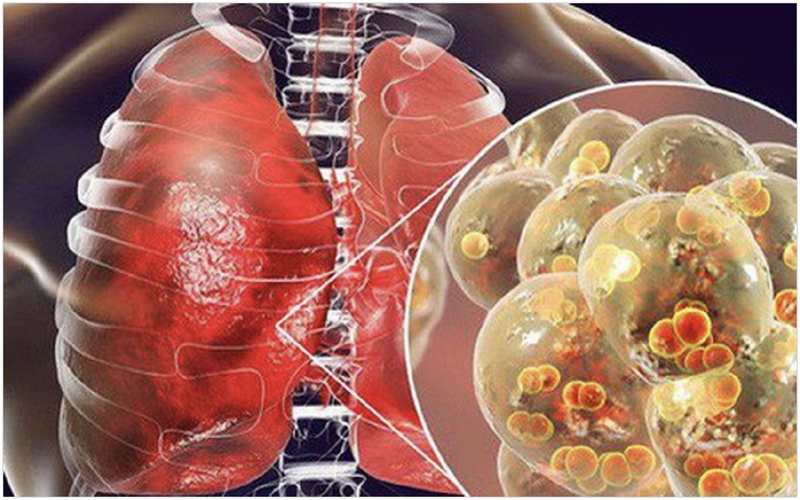 Tìm hiểu về nấm mốc Aspergillus niger 2
