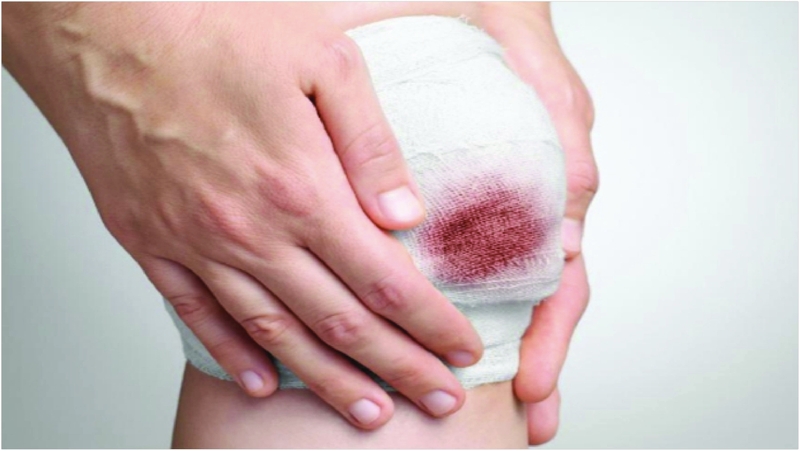 Tìm hiểu về nấm mốc Aspergillus niger 3