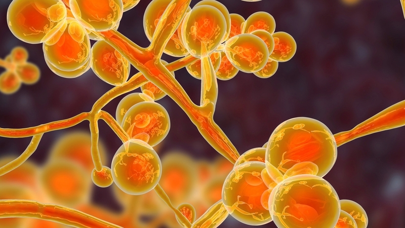 Nấm phổi: Nguyên nhân, triệu chứng, chẩn đoán và phương pháp điều trị 2