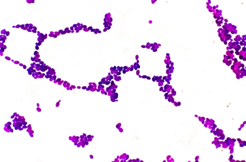 Nấm xung quanh miệng: Nguyên nhân và cách điều trị 2