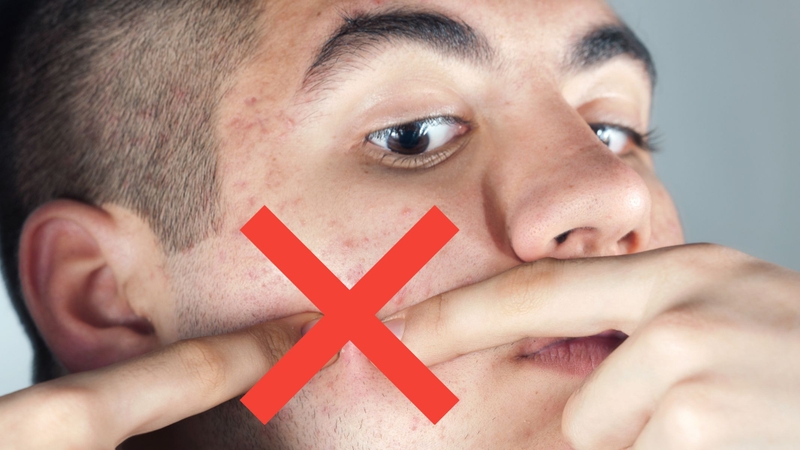 Khi nhận thấy dấu hiệu viêm nhiễm, đầu tiên cần làm là ngưng hoàn toàn việc bóp hoặc nặn mụn