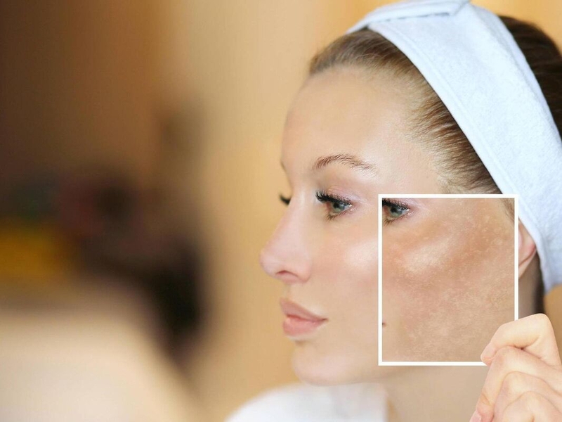 nắng 8 giờ sáng có làm đen da không 4