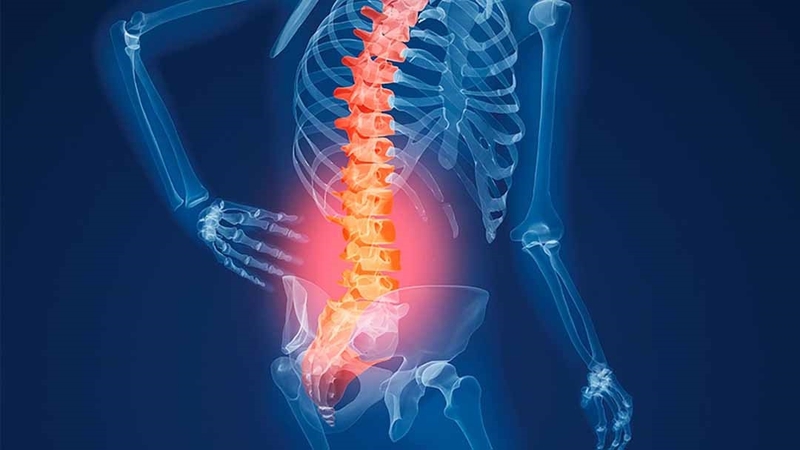 Nâng cao hiệu quả phòng ngừa loãng xương nhờ bộ ba Canxi - Magie - D3