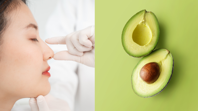 Nâng mũi ăn bơ được không? Một số điều cần lưu ý khi nâng mũi ăn bơ 1