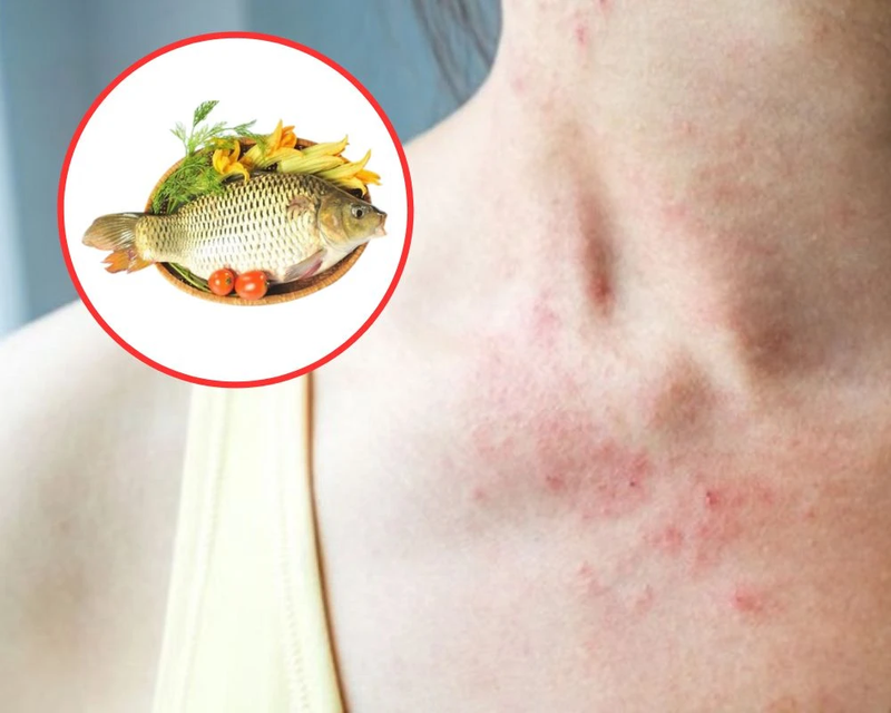 nang-mui-an-ca-loc-duoc-khong-giai-dap-va-huong-dan-che-do-dinh-duong-an-toan-hau-phau-thuat 2