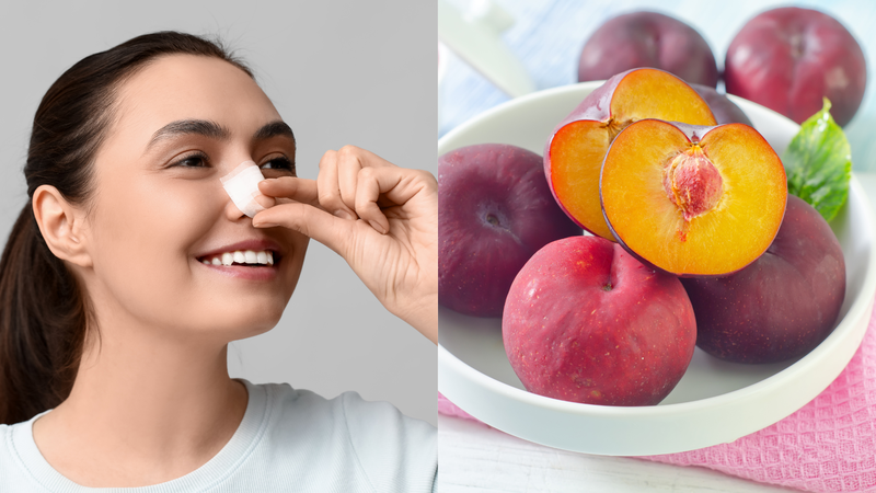 Nâng mũi ăn mận được không? Nâng mũi nên ăn trái cây gì? 1