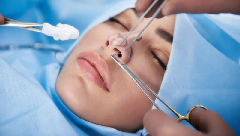 Những điều nên biết về nâng mũi cấu trúc trước khi thực hiện 3