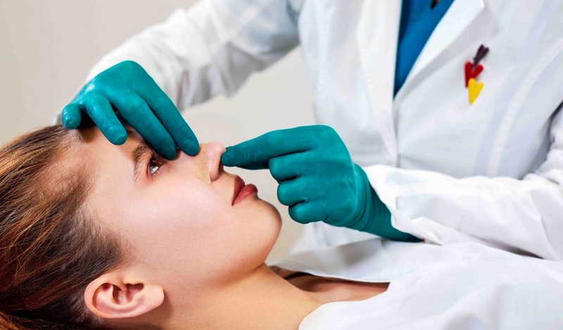 Nâng mũi bằng chỉ giá bao nhiêu? Hạn chế của nâng mũi bằng chỉ? 1