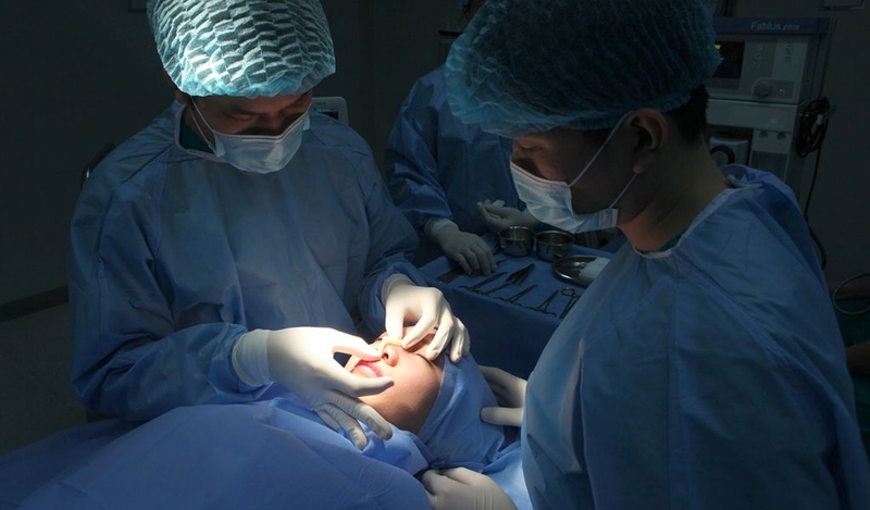 Nâng mũi bằng chỉ giá bao nhiêu? Hạn chế của nâng mũi bằng chỉ? 2