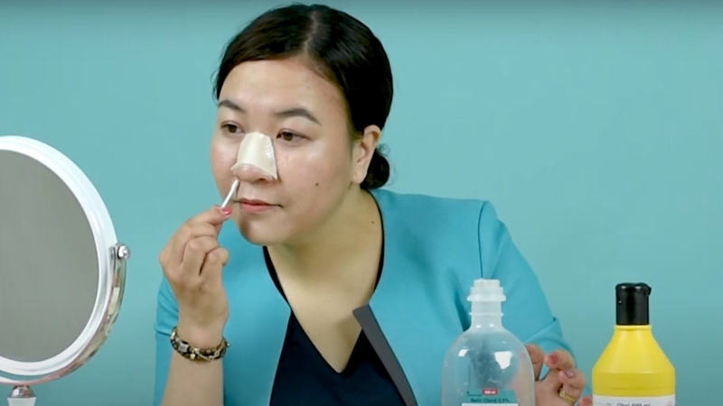 Chăm sóc kỹ càng sau khi nâng mũi