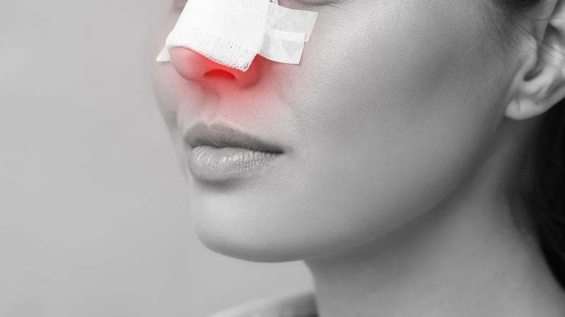 Sau nâng mũi bạn nên ăn uống theo tư vấn của bác sĩ